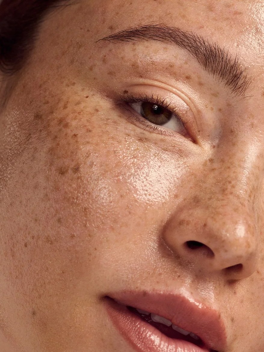 Close-up studio portrait highlighting freckles and natural skin texture