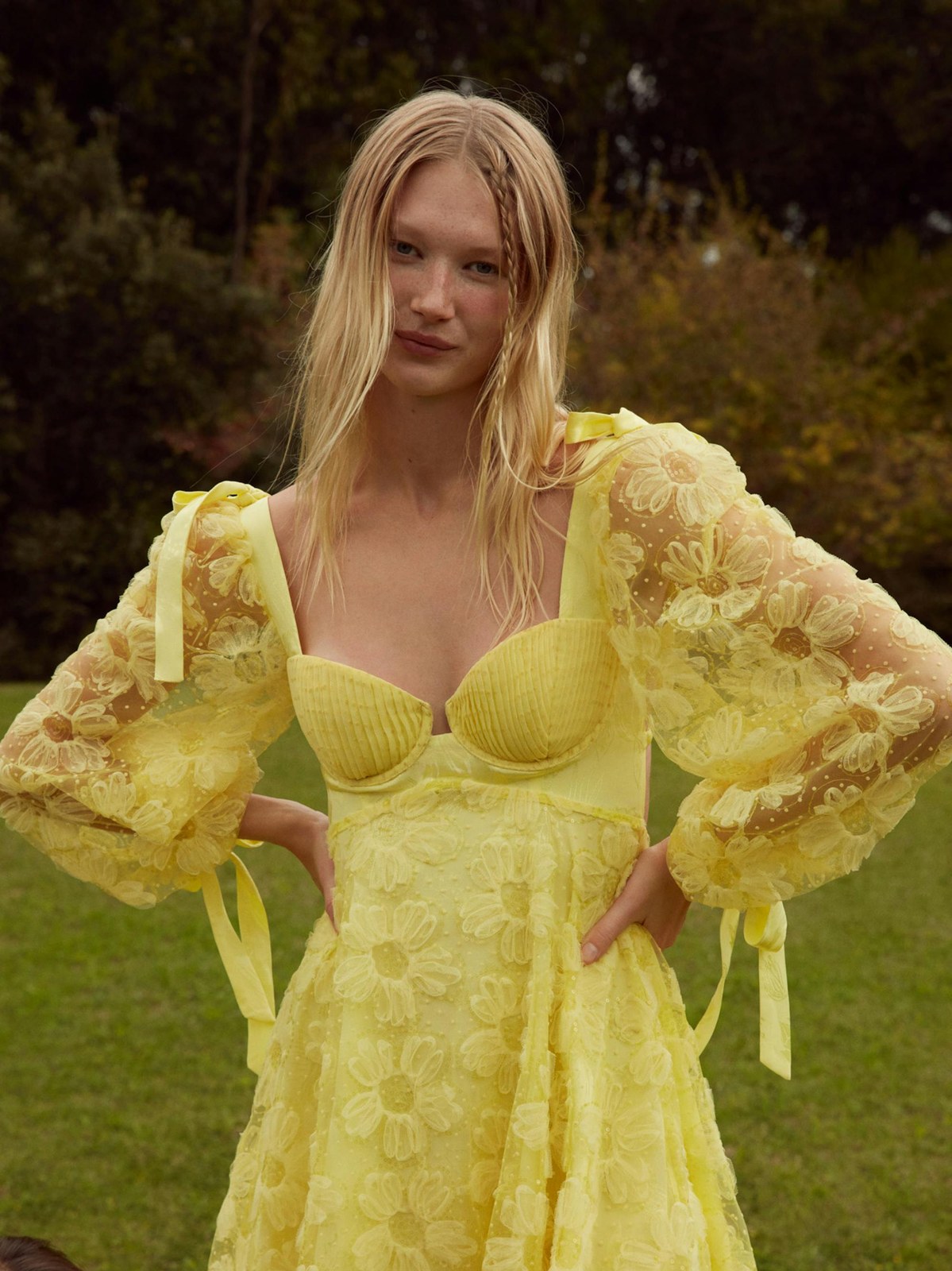 Model in a yellow floral mini dress outdoors on a green lawn