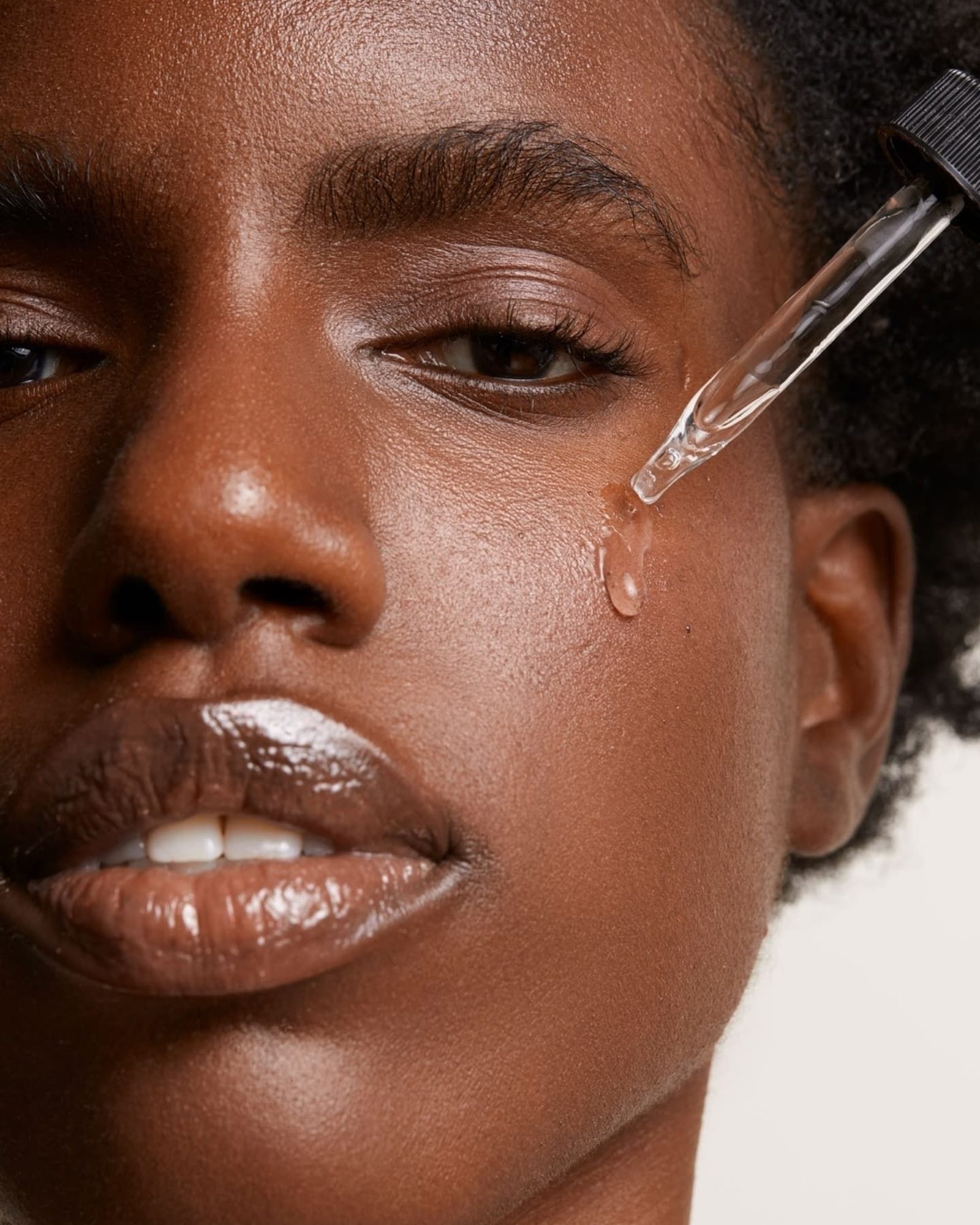 Naturium Azelaic Acid, the 10% Serum and Its Rivals